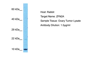 ZFAND2A Rabbit Polyclonal Antibody