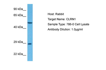 CLRN1 Rabbit Polyclonal Antibody