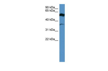 FSCN2 Rabbit Polyclonal Antibody