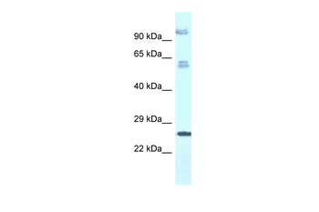TMEM222 Rabbit Polyclonal Antibody