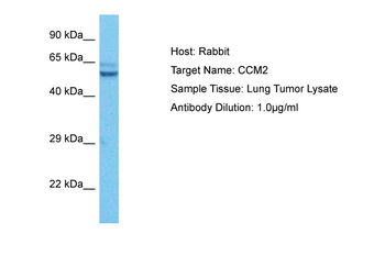 CCM2 Rabbit Polyclonal Antibody