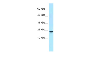 XAGE1D Rabbit Polyclonal Antibody