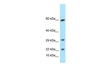 TRGC1 Rabbit Polyclonal Antibody