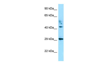 ATCAY Rabbit Polyclonal Antibody