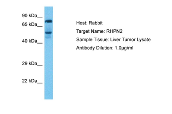 RHPN2 Rabbit Polyclonal Antibody