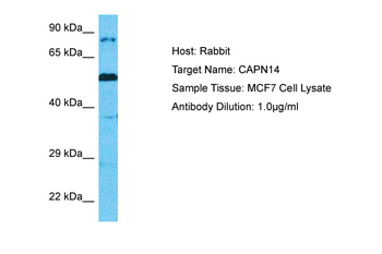 CAPN14 Rabbit Polyclonal Antibody