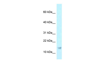 RPP21 Rabbit Polyclonal Antibody