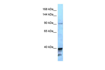 KIF7 Rabbit Polyclonal Antibody
