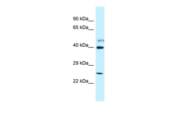 GRINL1A Rabbit Polyclonal Antibody