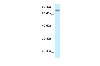 PPP6R3 Rabbit Polyclonal Antibody