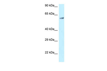 CLINT1 Rabbit Polyclonal Antibody