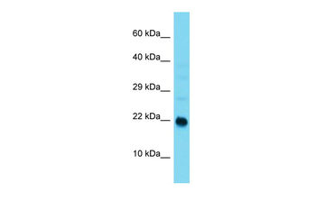 Arl9 Rabbit Polyclonal Antibody
