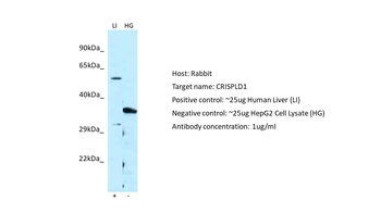 CRISPLD1 Rabbit Polyclonal Antibody
