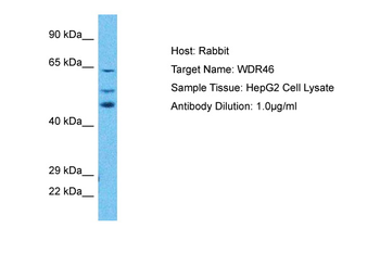 WDR46 Rabbit Polyclonal Antibody