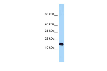 STH Rabbit Polyclonal Antibody