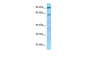GP5 Rabbit Polyclonal Antibody
