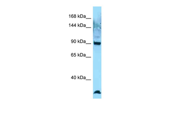 ROS1 Rabbit Polyclonal Antibody