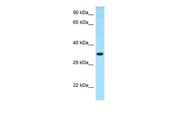 NTHL1 Rabbit Polyclonal Antibody