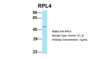 RPL4 Rabbit Polyclonal Antibody