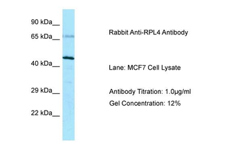 RPL4 Rabbit Polyclonal Antibody