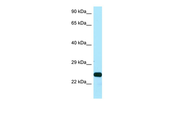 SSU72 Rabbit Polyclonal Antibody