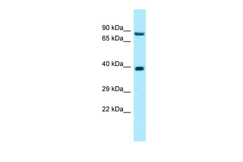 RPP30 Rabbit Polyclonal Antibody
