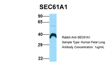 SEC61A1 Rabbit Polyclonal Antibody