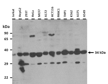 RDH8 Rabbit Polyclonal Antibody
