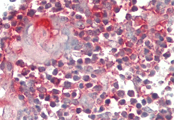 YRDC Rabbit Polyclonal Antibody