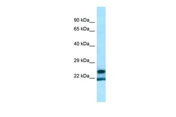YRDC Rabbit Polyclonal Antibody