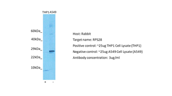 RPS28 Rabbit Polyclonal Antibody