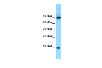 S100A7A Rabbit Polyclonal Antibody