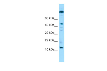 VCY Rabbit Polyclonal Antibody