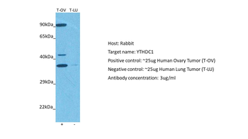 YTHDC1 Rabbit Polyclonal Antibody