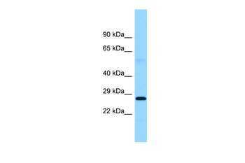 FTMT Rabbit Polyclonal Antibody