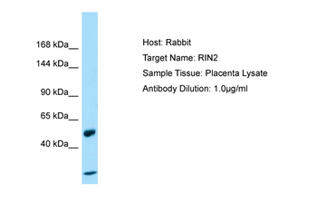 RIN2 Rabbit Polyclonal Antibody