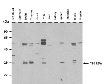 Chmp4c Rabbit Polyclonal Antibody