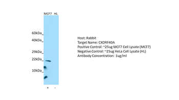 CXorf40A Rabbit Polyclonal Antibody