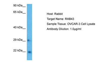 RAB43 Rabbit Polyclonal Antibody