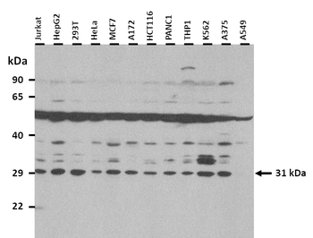 SPSB1 Rabbit Polyclonal Antibody