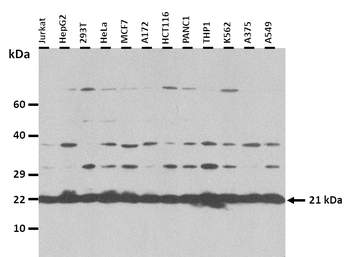ADAT2 Rabbit Polyclonal Antibody
