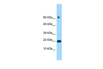 ADAT2 Rabbit Polyclonal Antibody