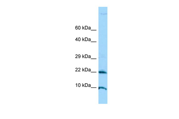 ADAT2 Rabbit Polyclonal Antibody