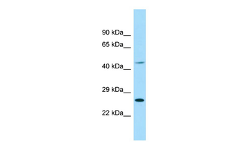 EIF4E1B Rabbit Polyclonal Antibody
