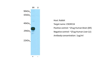 C9orf24 Rabbit Polyclonal Antibody