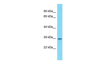 Olfr872 Rabbit Polyclonal Antibody