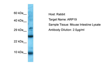 Arpp19 Rabbit Polyclonal Antibody