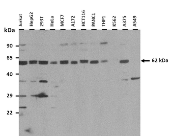 SYT14 Rabbit Polyclonal Antibody