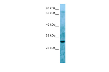 LBHD1 Rabbit Polyclonal Antibody