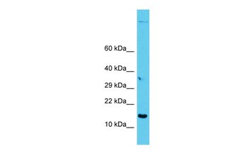 GAGE12I Rabbit Polyclonal Antibody